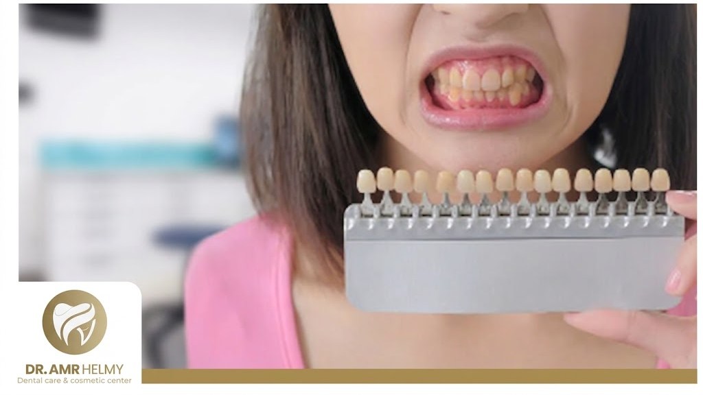 Yellow Teeth Causes
