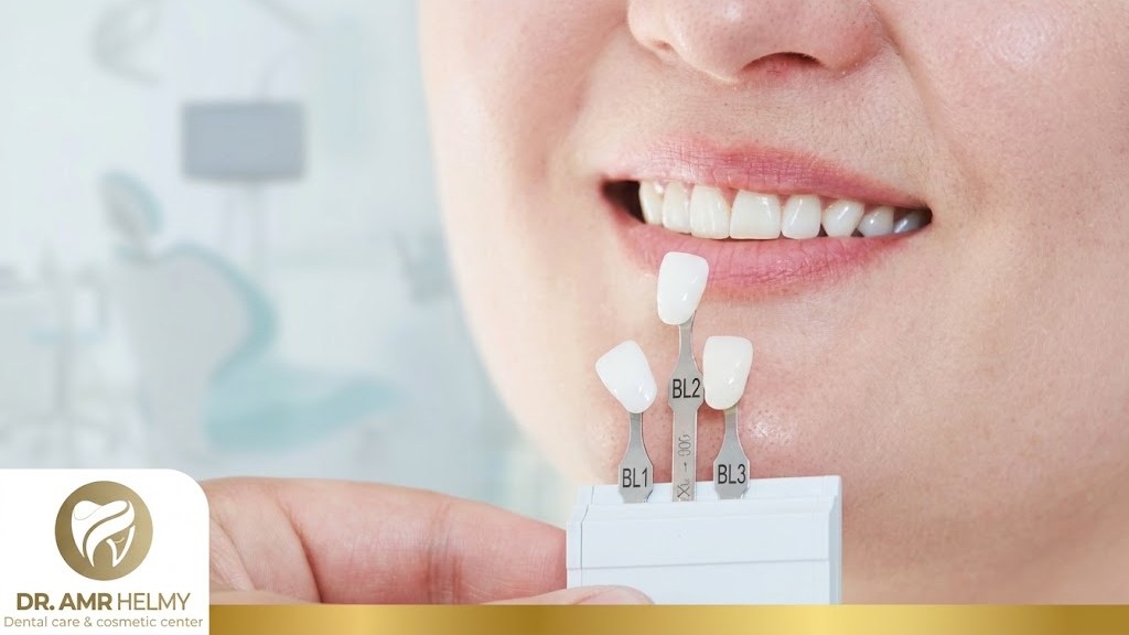 Prices of Removable Dental Veneers