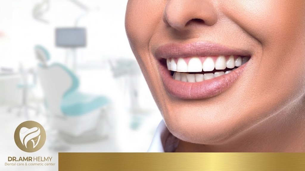 Hollywood Smile Price
